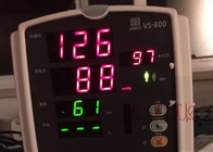 VS800 RESP NIBP SPO2 사용 환자 모니터 Mindray 심장 모니터