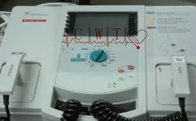 ICU를 위한 심인성 쇼크 사용된 세동제거기 기계 3 채널