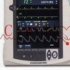 12 인치 아에드 심장 기계, 성인은 심장을 위한 전기 쇼크 기계를 사용했습니다