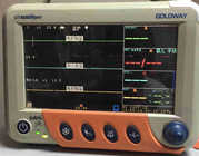 골드웨이 UT4000Apro는 12.1 인치 TFT 디스플레이와 환자 모니터를 사용했습니다