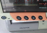 85dB 병원 생명징후 모니터, 사용된 필립 3000A 실시간 의료 모니터링 시스템